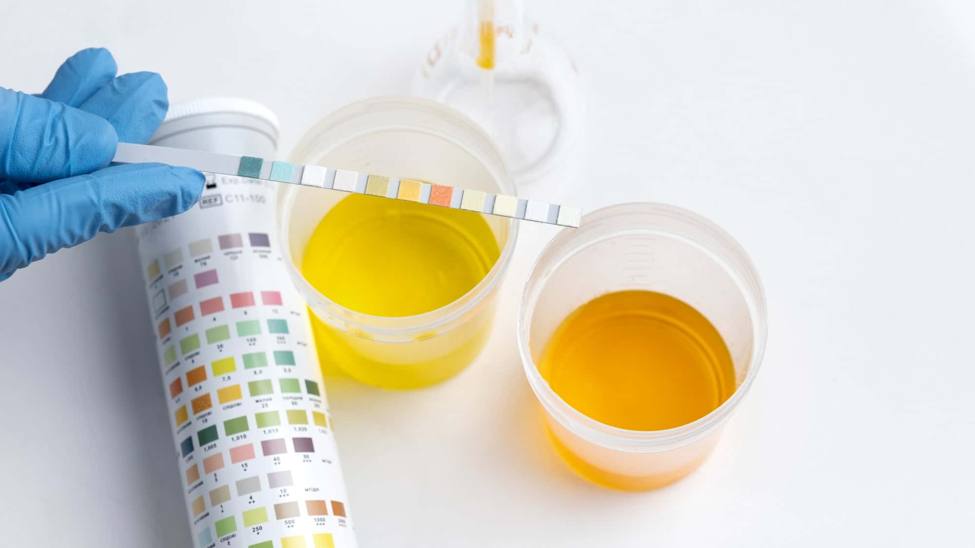 How Long Does THCA Stay In Your System